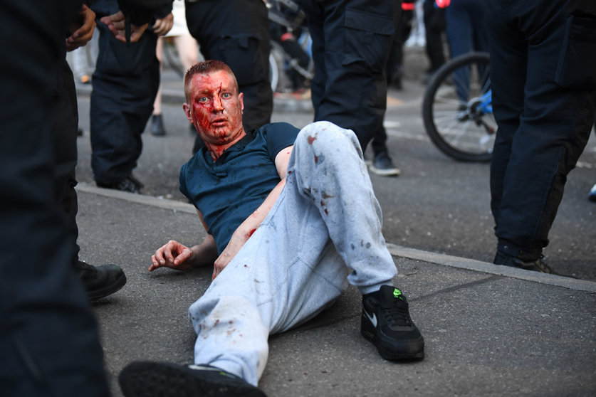 3 June 2020, England, London: A protester with blood on his face lies outside the Houses of Parliament during the right-wing movement Democratic Football Lads Alliance clash with a Black Lives Matter protest. Photo: Victoria Jones/PA Wire/dpa